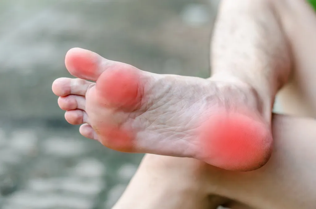 what to do to treat foot pain