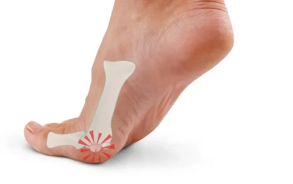 big toe joint pain and treatment