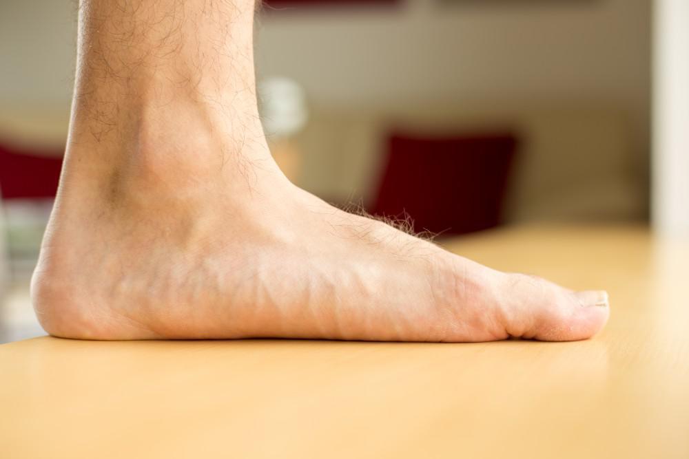 how to fix flat feet