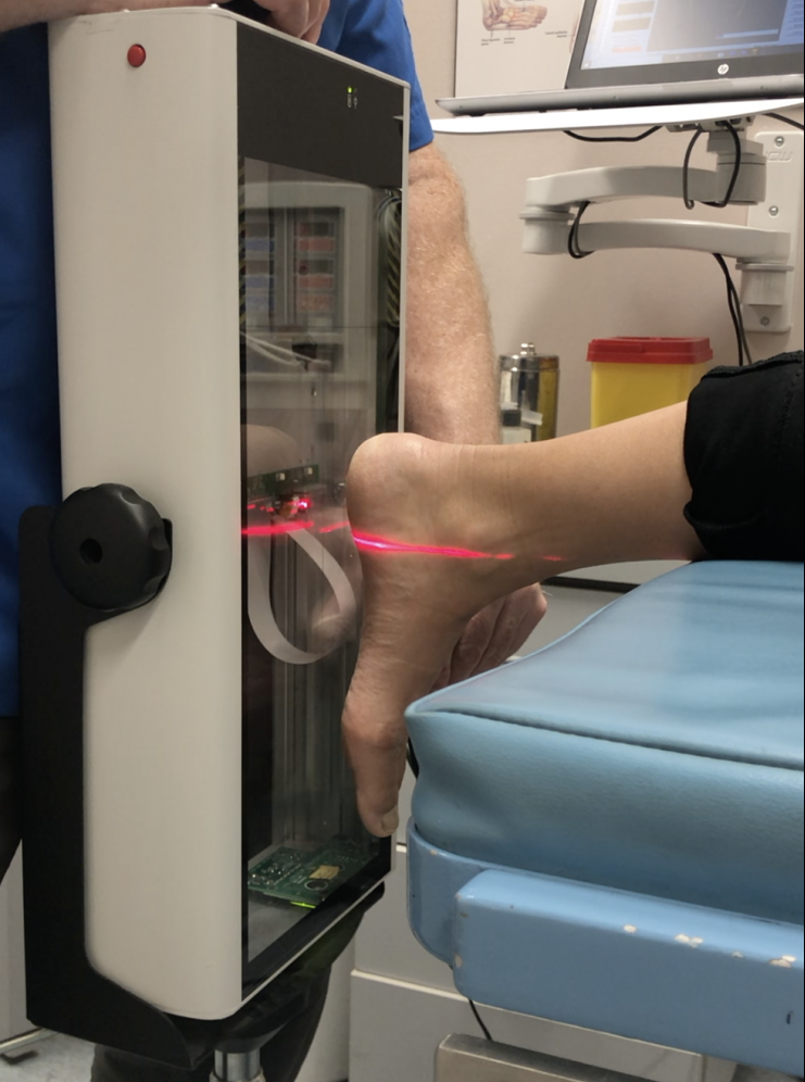 foot scanning